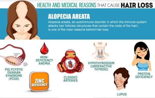 hair loss reasons