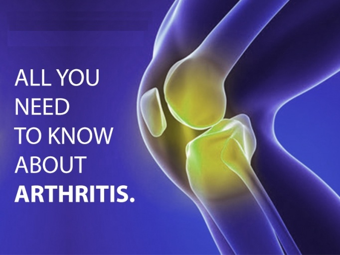 Things you might not have known about arthritis